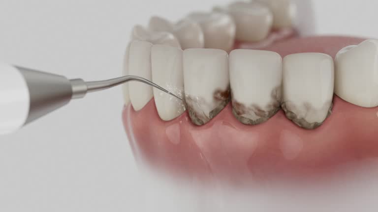 Reliable Tooth Extraction contractor in White County County, GA by Dentist Open Now